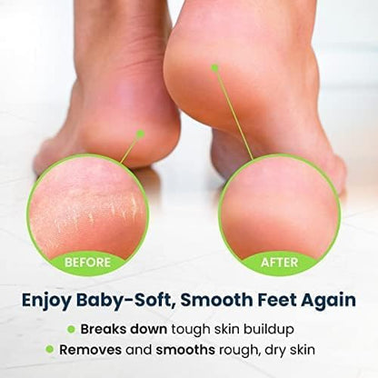 FOOT CURE Exfoliator & Callus Remover Pedicure Set – Care Kit Includes File for Dead Skin, Tea Tree Oil Soak Salts, Urea Cream 40 Percent Removal Gel Made in USA, Ivory, 4 Piece