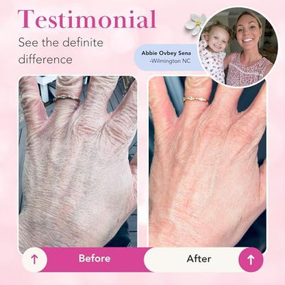 Theraplex Clear Emollient Lotion (8 oz) - No Parabens or Preservatives, Noncomedogenic and Hypoallergenic, Fragrance Free, Dermatologist recommended (6 Pack Pour)