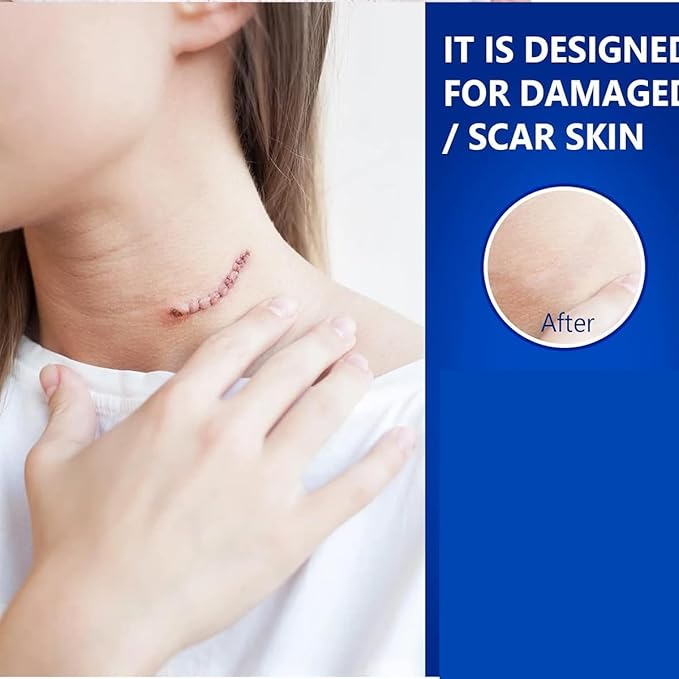 Advanced Scar Gel for Surgical Scars, Face, Body, Legs, Burns, Acne, C-Section, Stretch Marks, Keloids - Effective Scar Removal for Men and Women, Suitable for Old & New Scars (100% New -1 Bottle)