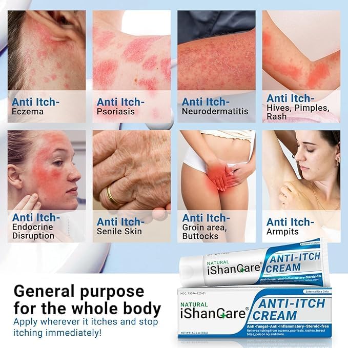 ishancare Anti Itch Soothing Cream Extra Strength Skin Itch Relief Ointment, for Full Body Itching Caused by Seasonal Changes, Dermatitis, Eczema, Rash, Psoriasis, Hives, Bites, Poison Ivy, 1.76 oz