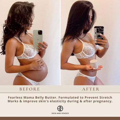 Fearless Mama Belly Butter – Luminous Scent Stretch Mark Cream for Pregnancy – Natural Moisturizer for Stretch Mark and Scar Care – Deep Hydration for Growing Bellies