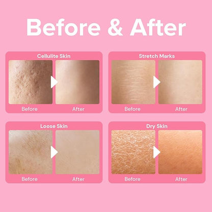Enaskin Naturals Anti-Cellulite Cream: Firming Solution for Booty, Legs & Belly - Skin Tightening & Lifting Body Mask for Toning, Lift & Firm Moisturizing Bum Bum Care