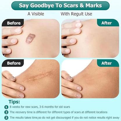 Advanced Scar Gel for Surgical Scars, Face, Body, Legs, Burns, Acne, C-Section, Stretch Marks, Keloids - Effective Scar Removal for Men and Women, Suitable for Old & New Scars (100% New -1 Bottle)