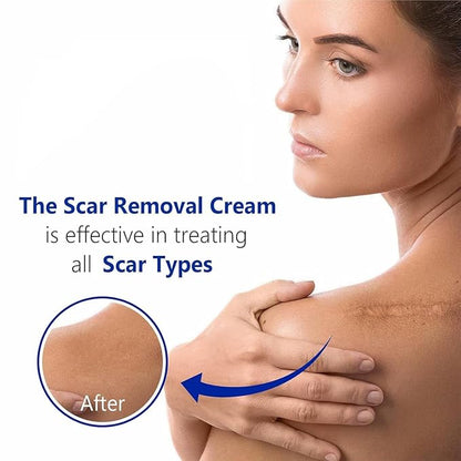 Advanced Scar Gel for Surgical Scars, Face, Body, Legs, Burns, Acne, C-Section, Stretch Marks, Keloids - Effective Scar Removal for Men and Women, Suitable for Old & New Scars (100% New -2 Bottle)