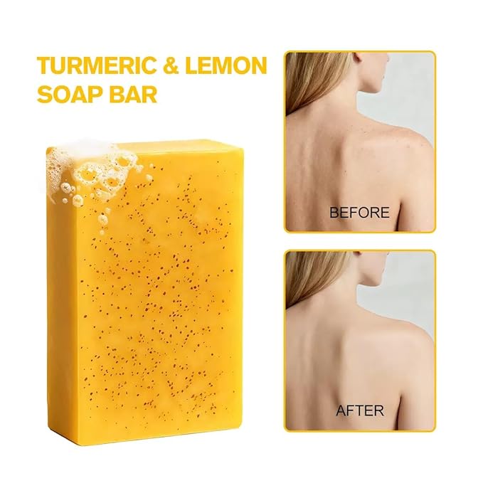 Kojic Acid Soap, Turmeric Soap Bar for Face and Body, Organic Daily Use Skin Care Turmeric Soaps for Women and Men, Gentle Cleansing Suitable for All Skin Types (1pcs)