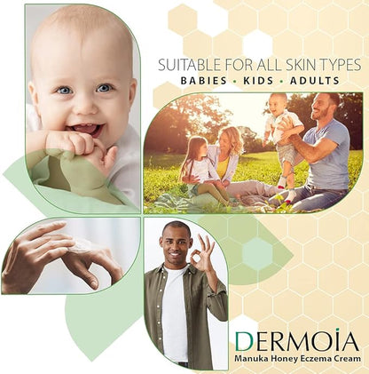 Manuka Honey Cream - Eczema Cream for Adults & Kids - Seborrheic Dermatitis Cream for All Skin Types - Eczema Honey Cream for Redness & Itch Skin Relief with Aloe Vera - 4oz