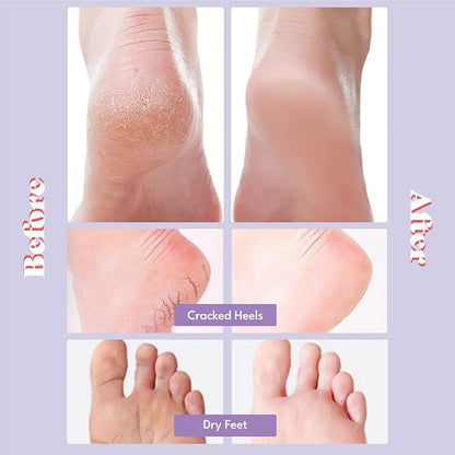 Toi:L Extra Silky Foot Mask 5 Pairs, Post-Peeling Foot Care Treatment, Moisturizing Socks with Guerande Salt & Sweet Almond Oil for Dry Feet, Cracked Heels, and Callus, Stocking Stuffer