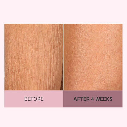 Consult Beaute Champagne Lift Hydrating Firming Body Cream with Pink Pepperslim for Crepey Skin Moisturizer Tightens, Tones & Hydrates Dry Skin on Arms & Legs - 8 oz.