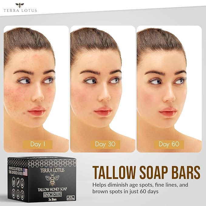 Organic Tallow Soap with Organic Castor Oil & Raw Honey - Relief for Dark Spots, Acne Marks, Hydrating & Nourishing - 3 Pack (Unscented)