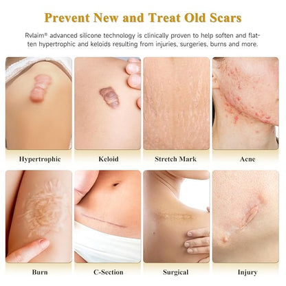 Silicone Scar Cream Scar Gel, Advanced Scar Cream for Surgical Scars, C-Section, Injury, Stretch Marks, Acne, Burns, Keloids, Old & New Scars, 1.85 Oz (55g)