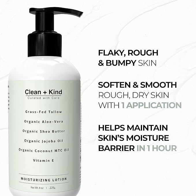 Daily Moisturizing Lotion – Tallow Body Lotion with Aloe Vera, Shea Butter, Jojoba Oil, MCT Oil & Vitamin E – Deep Hydration for Dry, Rough, Sensitive Skin (8 oz, Vanilla)