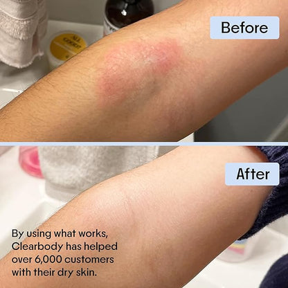 Clearbody Organics Oatmeal Lotion - 4 Fl Oz - Eczema Cream & Treatment - Natural Ointment for Eczema Manuka Honey Hydration Body Lotion
