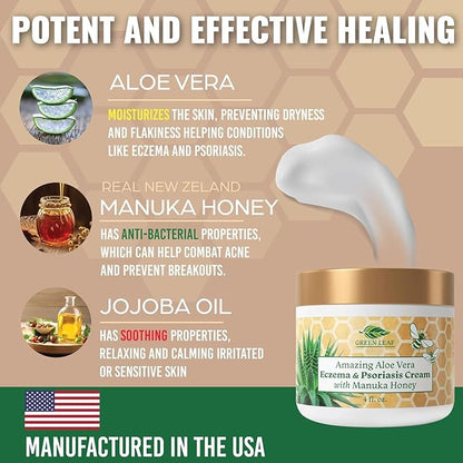 Manuka Honey Eczema Cream Moisturizing Lotion for Psoriasis Relief - Itchy, Dry Skin Rash Ointment - Soothing Moisturizer for Baby, Kids, Adults - High Strength Body & Face Cream 4oz