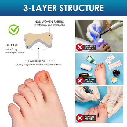 Ingrown Toenail Treatment, 50Pcs Breathable Ingrown Toenail Corrector Patches with Nail File & Lifter, Professional-Grade Treatment for Fast Results