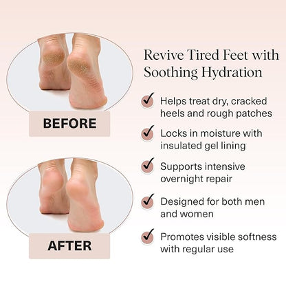 Kitsch Moisturizing Socks for Cracked Heel Treatment – Reusable Spa Socks for Women & Men with Insulated Gel Lining - Overnight Heel Socks for Dry Cracked Feet, Hydrating, Open-Toe Design - 1 Pair