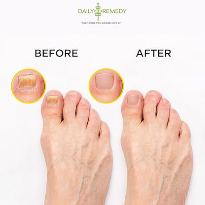 Citrus Detox Foot Soak with Epsom Salt - for Foot Callus, Immune Boost, Damaged Toenail, Athletes Foot, Pedicure and Soothes Tired Feet - Made in USA