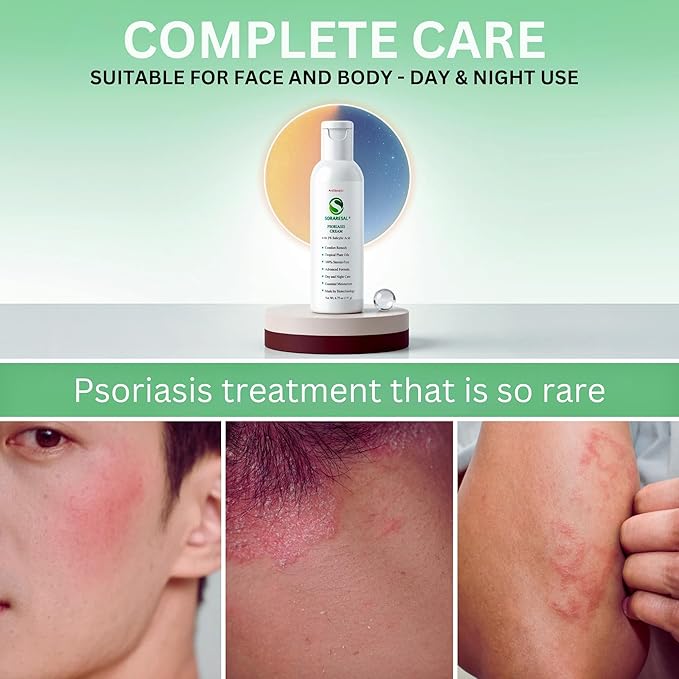 SORARESAL Psoriasis Cream – Comfort Remedy with Safflower Oil, Coconut Oil and Salicylic Acid for Itchy, Flaky Skin and Eczema Relief