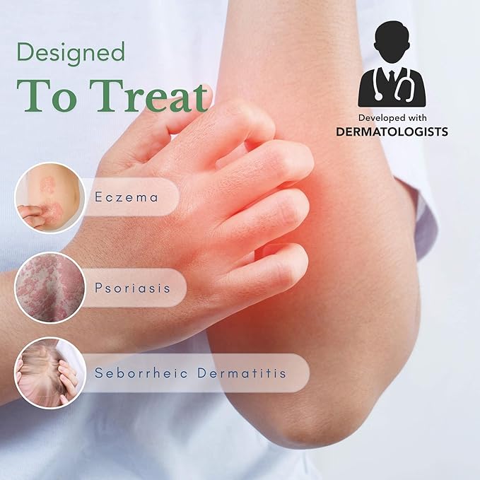 Theraplex AIM - Anti-Itch Moisturizing Cream (3 oz) - Non-stinging, Relieves Itching, Rashes, Flare Ups - Helps Repair & Restore the Skin's Natural Protective Barrier