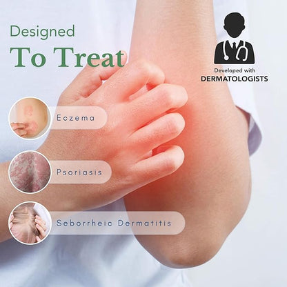 Theraplex AIM - Anti Itch Cream (2 oz) – 1% hydrocortisone for Itchy Skin Relief, moisturizing Cream for Eczema, Seborrheic Dermatitis. Safe for Kids. Relieves Itchy Skin with Maximum Strength.