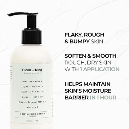 Daily Moisturizing Lotion – Tallow Body Lotion with Aloe Vera, Shea Butter, Jojoba Oil, MCT Oil & Vitamin E – Deep Hydration for Dry, Rough, Sensitive Skin (8 Fl Oz, Unscented)