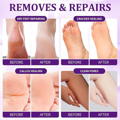 Pedicure Kit Foot Soak Set: Bubble Salt, Sugar Scrub, Massage Mask, Massage Lotion in a Box, 4 Step Foot Spa Kit for Dry Feet, Softens Calluses, Tired Feet（3 Set Lavender)