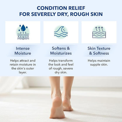 Urea 10% Lotion Cream for Extremely Dry, Rough and Scaly Skin, Intense Moisturizer and Gentle Exfoliator for Hands, Feet, Elbows and Knees Inc, 8 oz