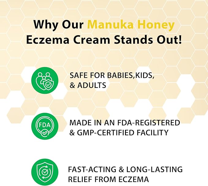 Manuka Honey Cream - Eczema Cream for Adults & Kids - Seborrheic Dermatitis Cream for All Skin Types - Eczema Honey Cream for Redness & Itch Skin Relief with Aloe Vera - 4oz