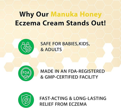 Manuka Honey Cream - Eczema Cream for Adults & Kids - Seborrheic Dermatitis Cream for All Skin Types - Eczema Honey Cream for Redness & Itch Skin Relief with Aloe Vera - 4oz