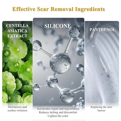Silicone Scar Cream Scar Gel, Advanced Scar Cream for Surgical Scars, C-Section, Injury, Stretch Marks, Acne, Burns, Keloids, Old & New Scars, 1.85 Oz (55g)