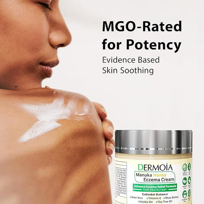 Manuka Honey Cream - Eczema Cream for Adults & Kids - Seborrheic Dermatitis Cream for All Skin Types - Eczema Honey Cream for Redness & Itch Skin Relief with Aloe Vera - 4oz