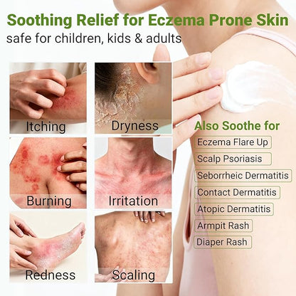 Eczema Cream, Psoriasis, Dermatitis & Rashes Treatment, Moisturizer for Dry, Itchy & Sensitive Skin, Face, Scalp & Body Soothing, Eczema Relief for Kids & Adults, 3.53 OZ