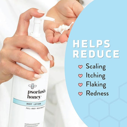 PSORIASIS HONEY Daily Moisturizing Body Lotion - Eczema & Seborrheic Dermatitis Cream for Itchy & Flaking - Moisturizing Psoriasis Treatment for Skin (16oz)