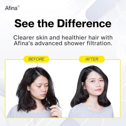 Afina Filtered Shower Head, Shower Filter for Hard Water | Improves Skin & Hair by Removing Chlorine & Toxic Chemicals from Hard Water (1.8 Gallon Per Minute California, Matte Black)