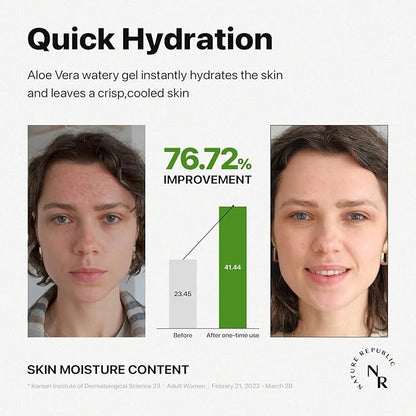 Nature Republic MILD & MOISTURE ALOE VERA WATERY GEL (1 PCS) Quick Hydration & Moisturizing,fast absorbing non-sticky texture,korean skin care for Face,Hair,Sunburn relief, aftershave, all Skin Types