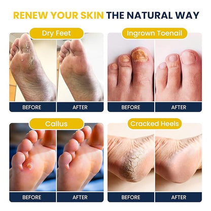 FOOT CURE Citrus Detox Foot Soak With Epsom Salts for Foot Callus, Immune Boost, Damaged Toenail, Athletes Foot, Pedicure and Soothes Tired Aching Feet - 16 oz (Pack of 2)