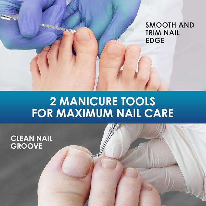 Ingrown Toenail Treatment, 50Pcs Breathable Ingrown Toenail Corrector Patches with Nail File & Lifter, Professional-Grade Treatment for Fast Results