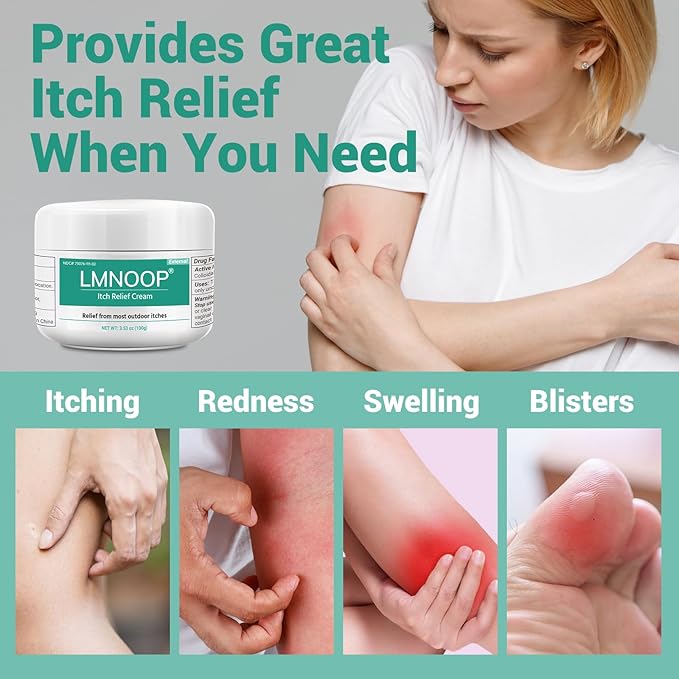 Anti Itch Cream, Extra Strength Anti-Itch Ointment, Relieves Rashes and Itching Caused by Insect Bites, Sunburns, Pet Hair, Dust Contact Allergies, and Poison Ivy, Poison Oak, and Poison Sumac 3.53OZ