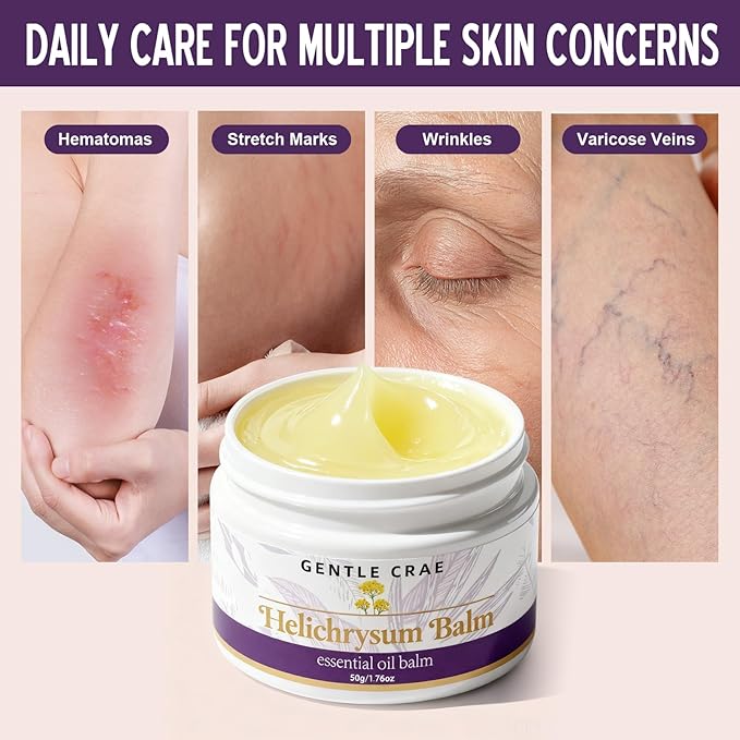 Extracts Helichrysum Balm — Moisturizing Helichrysum Essential Oil Balm, Beeswax & Almond Oil, Multipurpose Salve for Dry & Irritated Skin, Stretch Marks, Scars, Hydrating Relief, 1.76oz