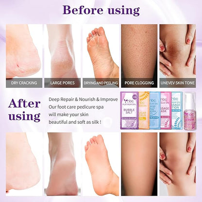 Pedicure Foot Soak Set - Upgraded 6 in 1 Foot Spa, Foot Bath Spa, Pedicure Kit for Tired & Dry Cracked Feet, Athletes Feet, Bad Odor, Softens Calluses (3 Set Lavender)