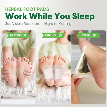 Natural Cleansing Foot Pads - Ginger Mugwort Bamboo Vinegar - Relieves Stress and Fatigue - Improves Sleep and Supports Body Cleansing - Premium Foot Care - 30 Pads (Pack of 1)