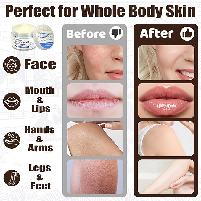 Beef Tallow for Skin, Natural Beef Tallow for Face, 100% Organic Grass Fed Finished Whipped Tallow and Honey Balm, Tallow Cream for Skin Care, Tallow Face Moisturizer Body Lotion