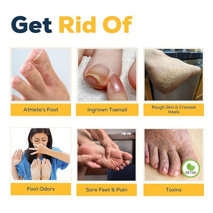 FOOT CURE Tea Tree & Citrus Foot Soak with Epsom Salt – Supports Tired Feet, Softens Calluses, and Refreshes (Pack of 2)