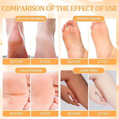 Foot Pedicure Spa Set,Foot Soak Spa Home Pedicure Kit with Bath Salt, Moisturizing Foot Scrub Cream Lotion, Foot Care for Dead Skin, Dry Cracked Feet, Make Baby Soft Feet, 3 Set