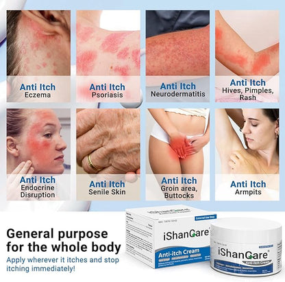 ishancare Anti Itch Cream Extra Strength, Oatmeal Soothing Skin Itch Relief Ointment for Rash, Dermatitis, Eczema, Psoriasis, Hives, Sun, Bites, Poison Ivy, Large Can 3.5 oz
