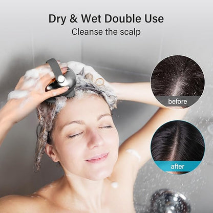 arboleaf Scalp Massager Rechargeable Head Massager Scalp Stress Relax, Waterproof Handheld Hair Scratcher with 8 Removable Massage Claws, Gift for Dad Mom