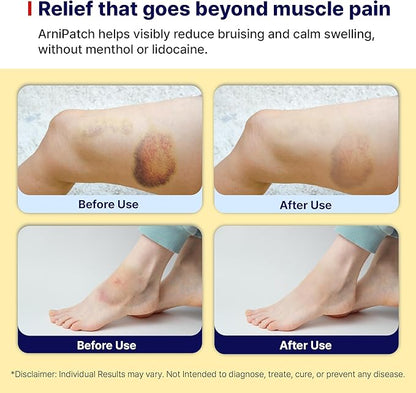 Arnica Hydrogel Pain Relief Patches | Natural Relief for Muscle, Joint, Bruises & Swelling | Flexible, Non-Greasy & Long-Lasting | Great for Back, Knee & Neck Pain (3.9"x4.7", 10, Count)