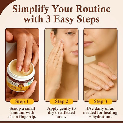 Sweet Bee Magic All In One Healing Organic Balm - Natural Skin Healing Cream, Beeswax Balm for Dry Skin, Face & Body Moisturizer - Certified Organic, All Natural Aid - (4oz Each, 24oz Total)