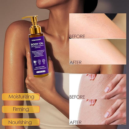 Vitae Charm Body Oil, Luxury Body Oil for Crepe Skin, Firming Tightening & Hydrating Body Serum with Vitamin E and Sweet Almond Oil, Smooths Skin for Women