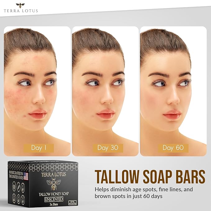 Organic Tallow Soap with Organic Castor Oil & Raw Honey - Relief for Dark Spots, Acne Marks, Hydrating & Nourishing - 3 Pack (Lavender)