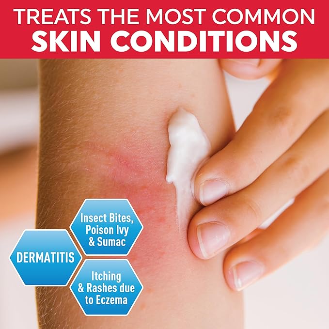 MED Pride 1% Hydrocortisone Cream Bulk 16 Oz Maximum Strength Itch Relief for Eczema, Dermatitis, Rashes, Mosquito Bites